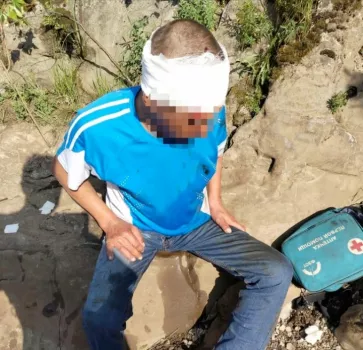 Мужчина сорвался со скалы в парке «Шагни за горизонт» и уехал оттуда в карете скорой помощи