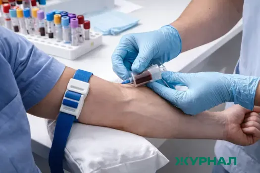 Уровень сахара в крови после еды увеличивает риск болезни Альцгеймера