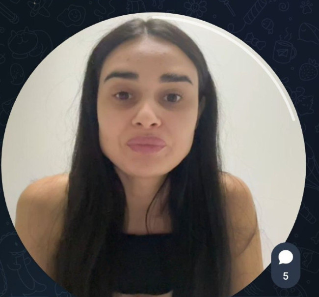 Гульназ Асаева рассказала о пластической операции из-за низкой самооценки