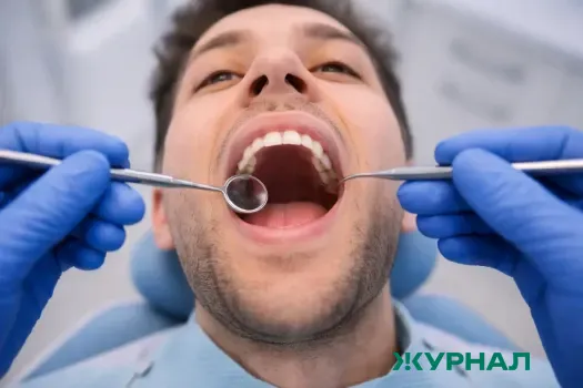 Эксперты из Уфы рассказали о ранних признаках рака полости рта